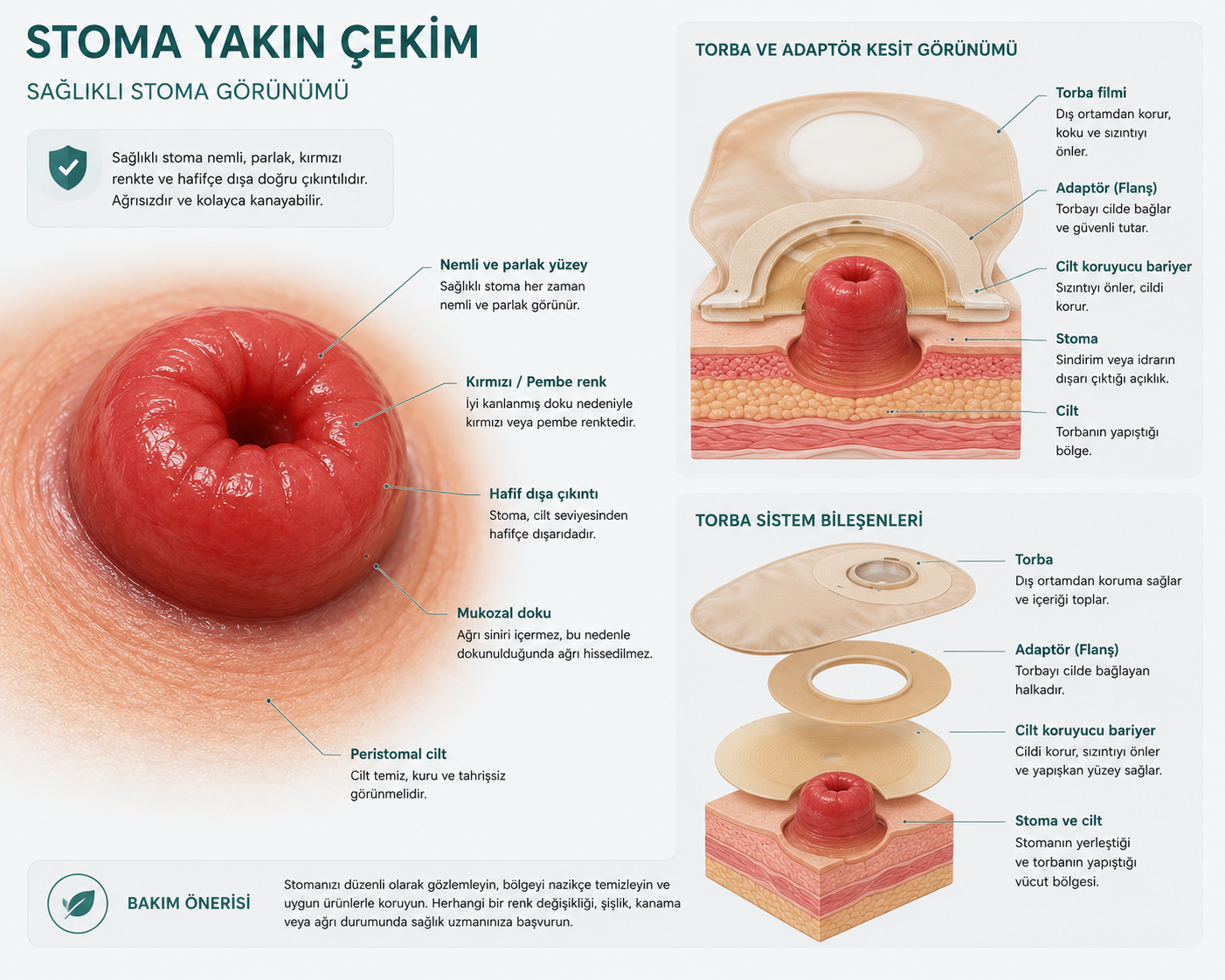 Sağlıklı stoma yakın çekim — pembe-kırmızı, nemli, hafifçe dışa kabarık
